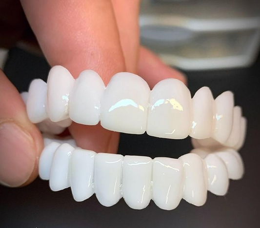 Removable Cosmetic Dental Veneer for Natural Looking Smile